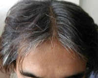 白髪は、四ヶ月前の化学染毛剤の髪に覆われて、下にかくれている