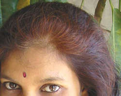 おでこの上の白髪の固まりが、まは流インド式ヘナ白髪染めでこんな感じ！